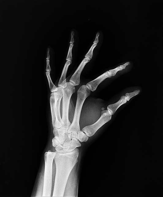 Dual Diagnosis Centers Rivervale New Jersey